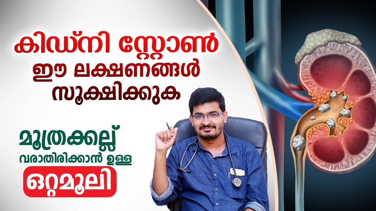 ഇത്തരം കാര്യങ്ങൾ ശ്രദ്ധിച്ചാൽ കിഡ്നി സ്റ്റോണിന് ഇല്ലാതാക്കാം.