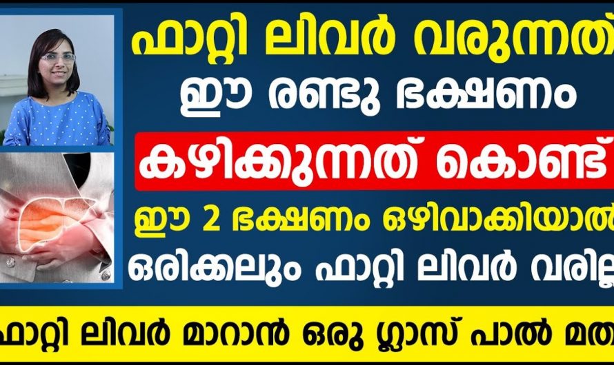 ഇത്തരം ഭക്ഷണങ്ങൾ കഴിക്കുന്നതും മൂലമാകാം ഫാറ്റി ലിവർ ഉണ്ടാകുന്നത്.