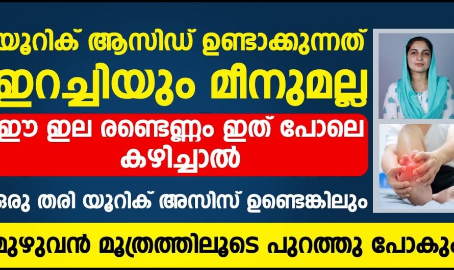 യൂറിക്കാസിഡ് മൂലം ബുദ്ധിമുട്ടുന്നവർ ഇതൊന്നും അറിഞ്ഞിരിക്കുക…