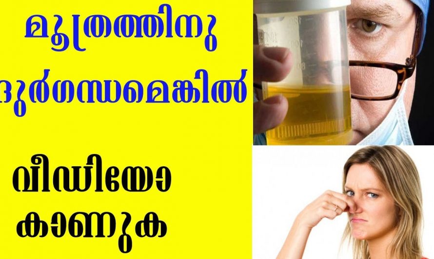 മൂത്രത്തിന്റെ ദുർഗന്ധം പ്രത്യേകം ശ്രദ്ധിക്കണം.