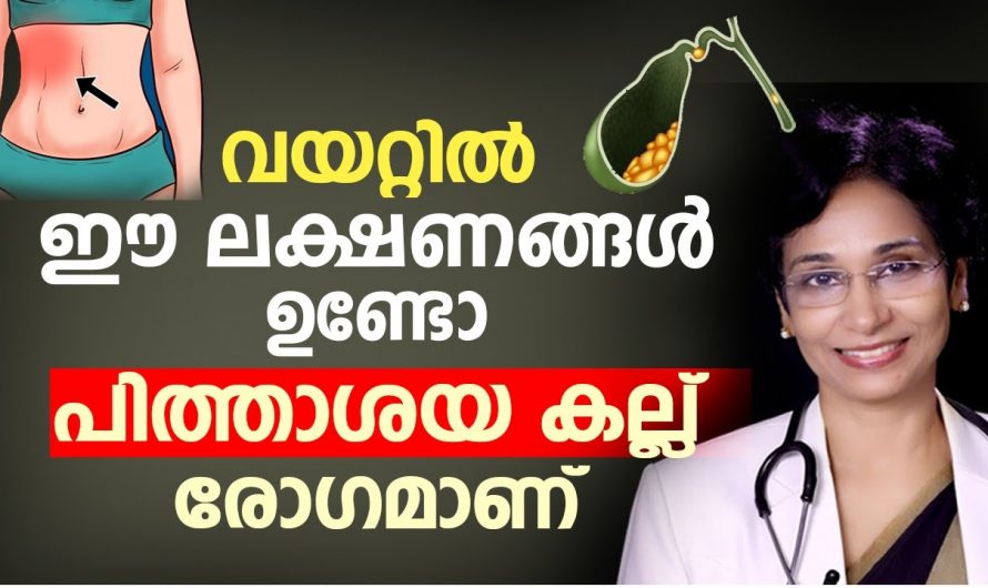 ലക്ഷണങ്ങൾ നിങ്ങളുടെ വയറിൽ ഉണ്ടോ എങ്കിൽ ശ്രദ്ധിക്കുക.