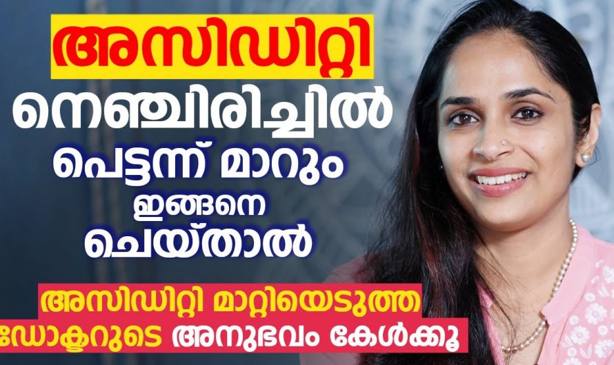 ഡോക്ടർ ഒന്ന് പറയുന്നത് കേൾക്കൂ നെഞ്ചിരിച്ചിൽ അല്ലെങ്കിൽ അസിഡിറ്റി പെട്ടെന്ന് മാറും