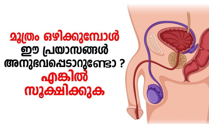 മൂത്രമൊഴിക്കുമ്പോൾ ഇത്തരം പ്രയാസങ്ങൾ അനുഭവപ്പെടുന്നു എങ്കിൽ ശ്രദ്ധിക്കുക.