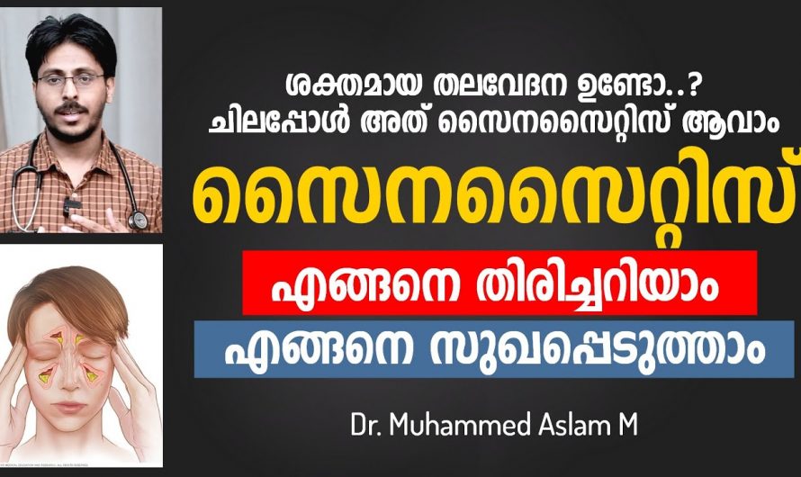 സൈനസൈസിന്റെ പ്രധാനപ്പെട്ട രോഗലക്ഷണങ്ങൾ…