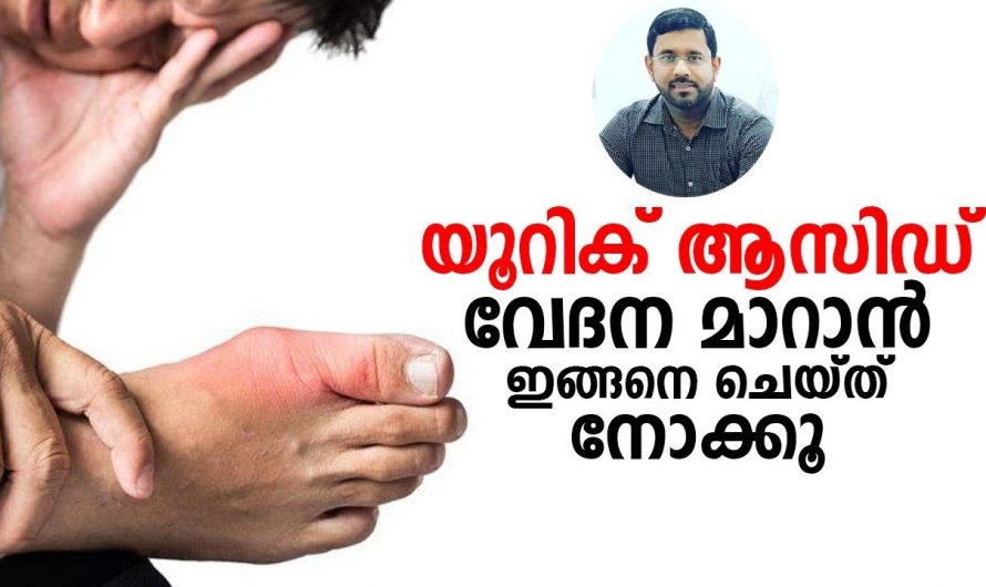 ഇങ്ങനെ ഒന്ന് ചെയ്തു നോക്കൂ യൂറിക്കാസിഡ് മൂലം ഉണ്ടാകുന്ന പ്രശ്നങ്ങൾ മാറും