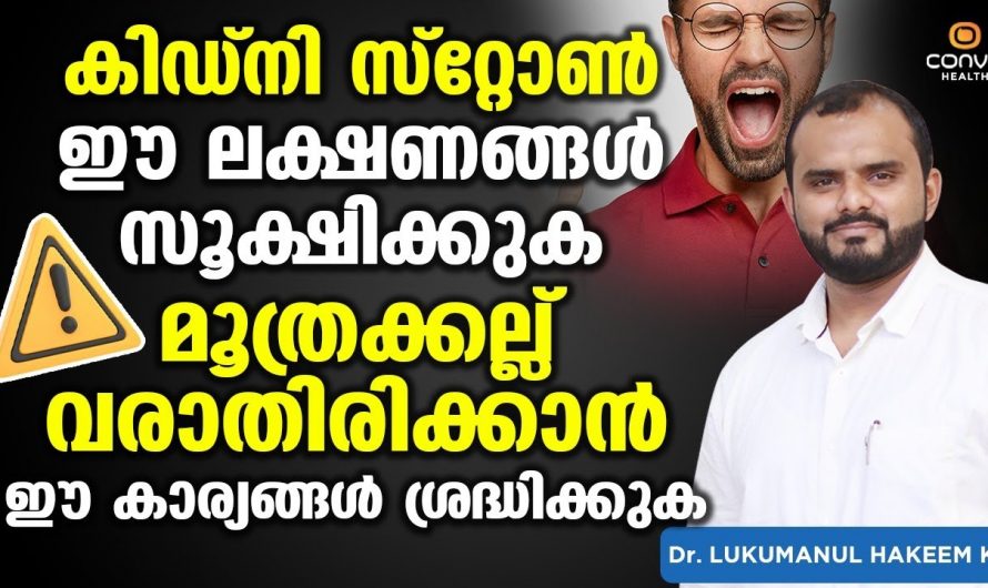 ഇത്തരത്തിലുള്ള ലക്ഷണങ്ങൾ കിഡ്നി സ്റ്റോണിന്റെ ആയിരിക്കും.