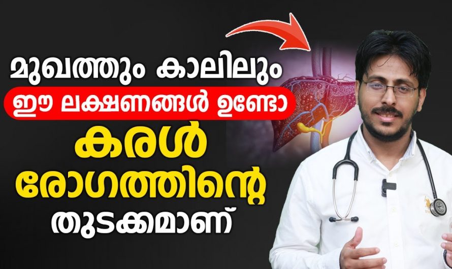 ഇത്തരം ലക്ഷണങ്ങൾ കരൾ രോഗത്തിന്റേത് ആണോ എന്ന് നമുക്ക് മനസ്സിലാക്കാം