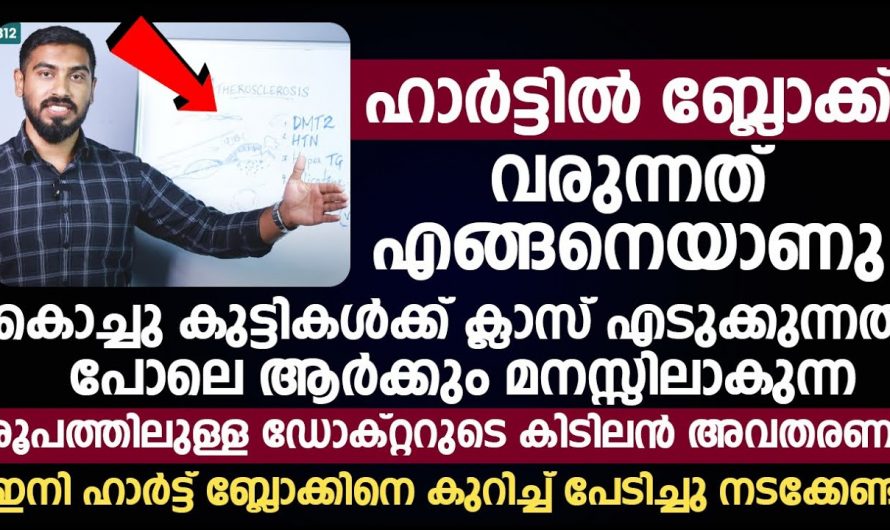 ഹാർട്ട് ബ്ലോക്ക് ഉണ്ടാകുന്നതിന് കൊളസ്ട്രോൾ മാത്രമല്ല കാരണം.