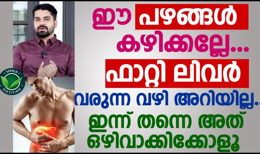 ഇത്തരം പഴവർഗ്ഗങ്ങൾ കഴിക്കുന്നത് ഫാറ്റ് ലിവറിന് കാരണമാകും…