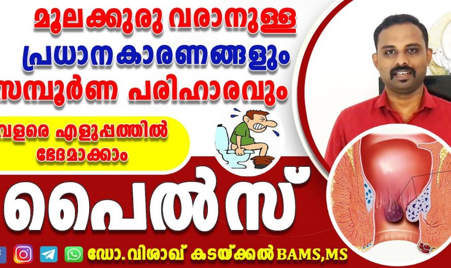 പൈൽസ് അഥവാ മൂലക്കുരു  പരിഹരിക്കാൻ കിടിലൻ മാർഗ്ഗം..