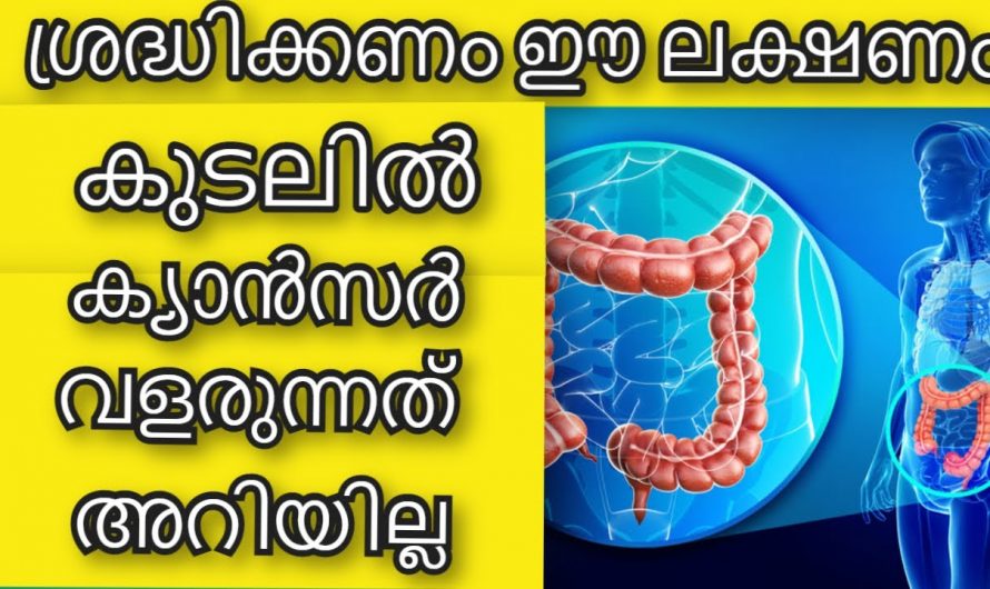 വൻകുടലിൽ ഉണ്ടാവുന്ന ക്യാൻസറിന്റെ പ്രധാനപ്പെട്ട ലക്ഷണങ്ങൾ..