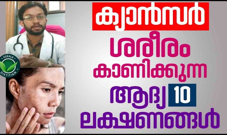 ഇത്തരം ലക്ഷണങ്ങൾ ഉണ്ടെങ്കിൽ പ്രത്യേകം ശ്രദ്ധിക്കുക ക്യാൻസറിന്റെ ആയിരിക്കും..