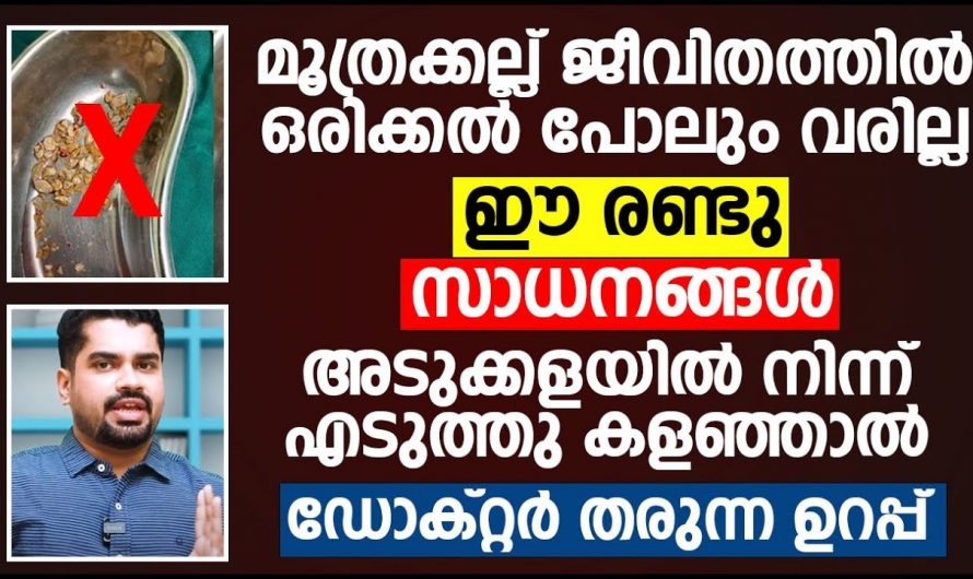 കിഡ്നി സ്റ്റോൺ വരാതിരിക്കാൻ ഇത്തരം കാര്യങ്ങൾ ശ്രദ്ധിക്കുക..