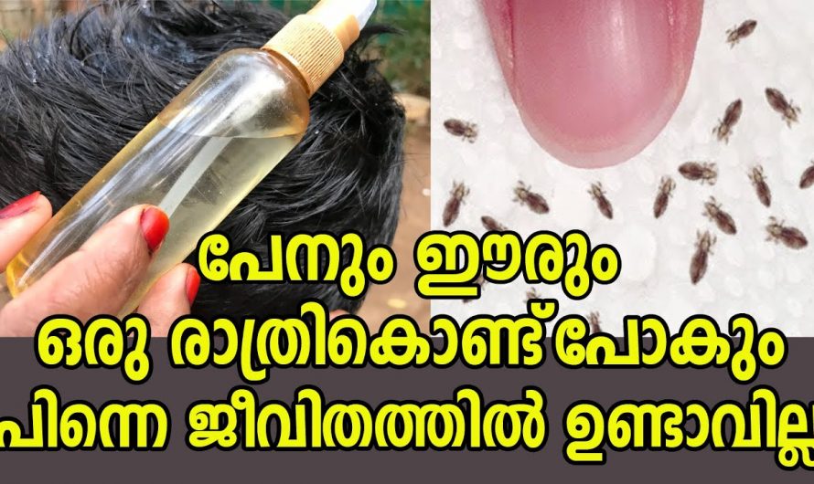 തലമുടിയിലെ താരൻ പേൻ എന്നിവ പരിഹരിച്ച് മുടിയെ സംരക്ഷിക്കുവാൻ…