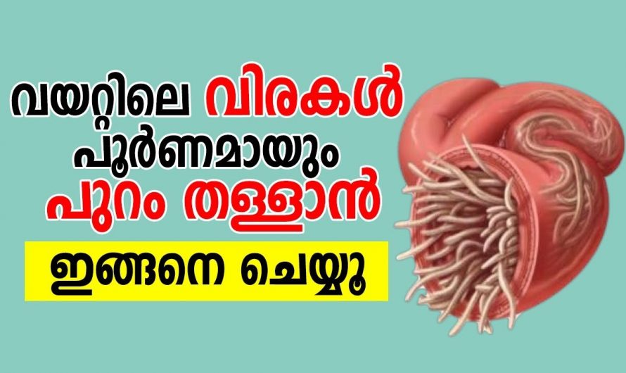 ഇനി വിര ശല്യത്തെ കുറിച്ച് പേടിക്കേണ്ട കാര്യമില്ല ഇതൊന്നു പരീക്ഷിക്കൂ