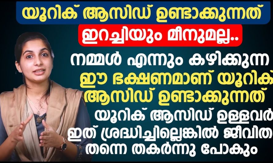 യൂറിക്കാസിഡ് പരിഹരിക്കാൻ ഇത്തരം കാര്യങ്ങൾ പ്രത്യേകം ശ്രദ്ധിക്കുക…