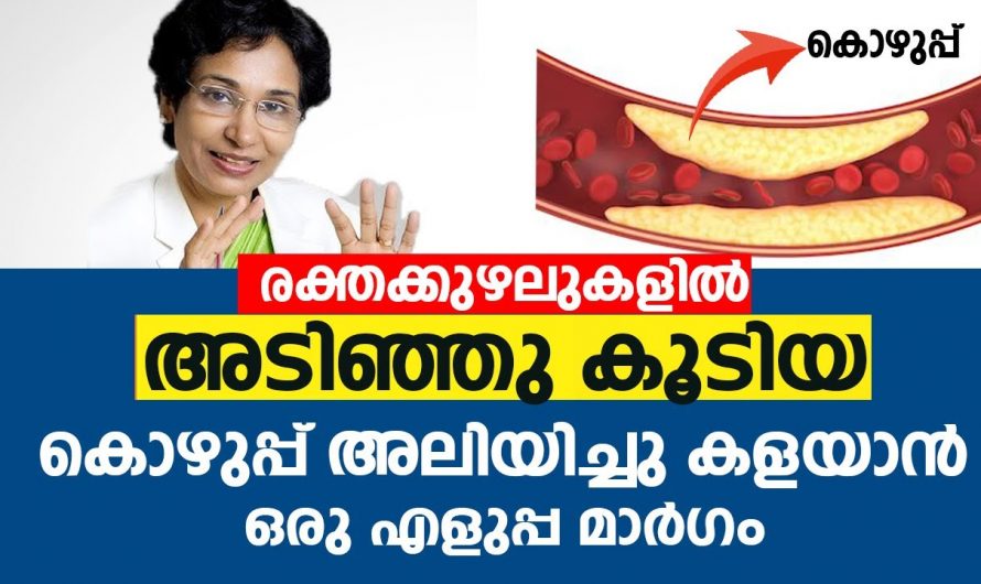 കൊളസ്ട്രോൾ പരിഹരിക്കുന്നതിനും ആരോഗ്യത്തെ സംരക്ഷിക്കാനും ഇത്തരം കാര്യങ്ങൾ ശീലമാക്കു….