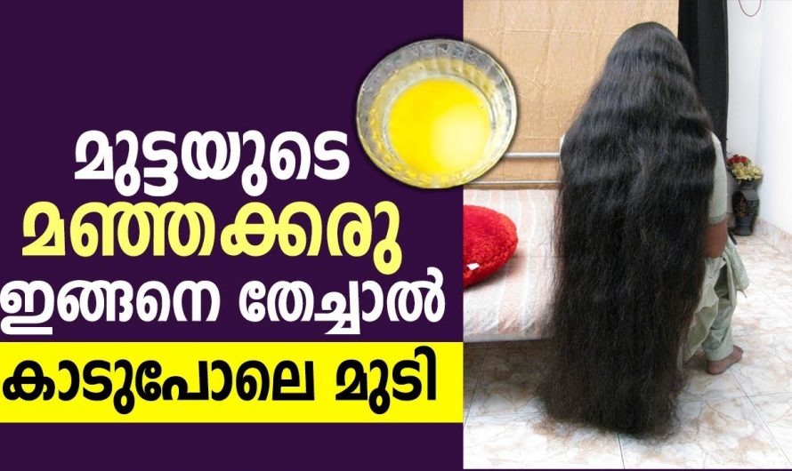 നല്ല ആരോഗ്യമുള്ള കരുത്തുള്ള കറുത്ത  മുടിയിഴകൾ ലഭിക്കാൻ..