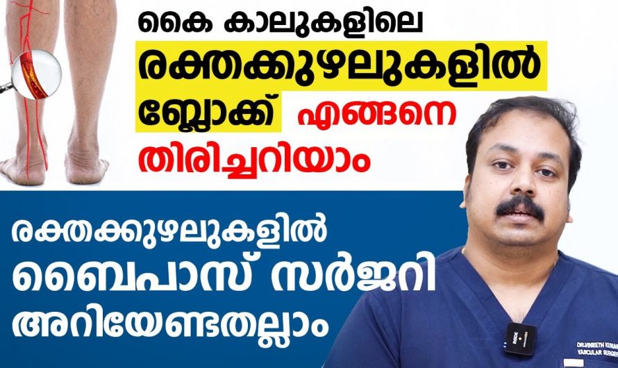 കൈകാലുകളിൽ ഉണ്ടാകുന്ന ബ്ലോക്കുകൾ എങ്ങനെ തിരിച്ചറിയാം..