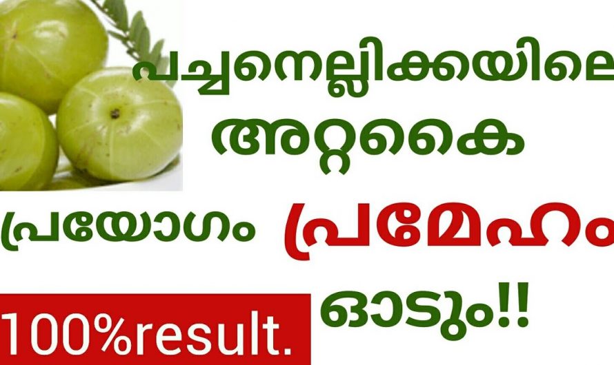 എത്ര കടുത്ത പ്രമേഹവും നോർമൽ ആക്കാൻ ഇതാ കിടിലൻ വഴി..