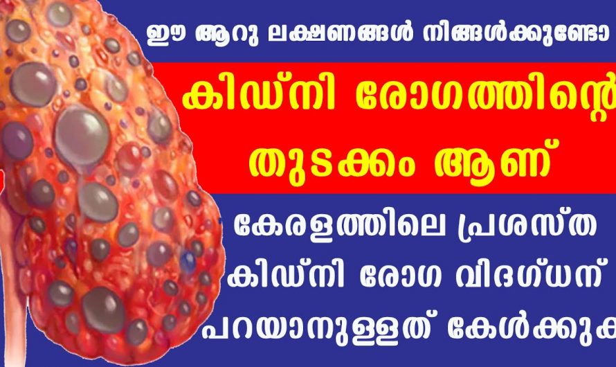 വൃക്ക തകരാറുകളും  പ്രധാനപ്പെട്ട ലക്ഷണങ്ങൾ.