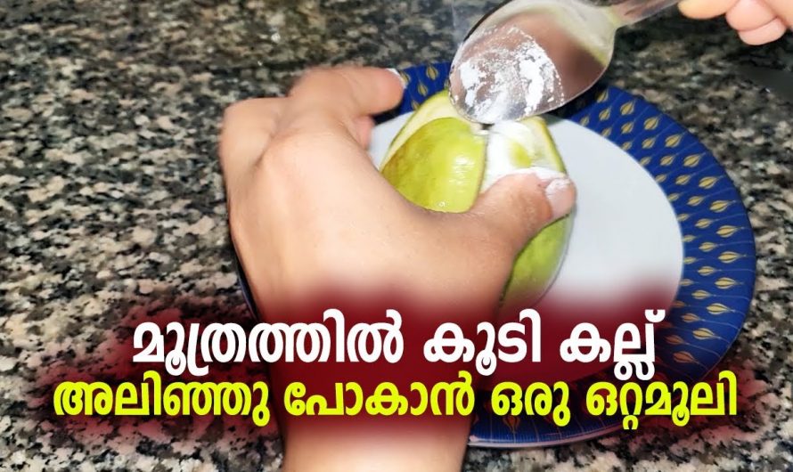 മൂത്രത്തിൽ കല്ല്  അഥവാ കിഡ്നി സ്റ്റോൺ പരിഹരിക്കാൻ ഇതാ കിടിലൻ വഴി….