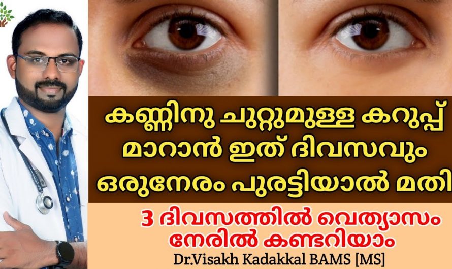 കണ്ണിന് ചുറ്റുമുള്ള കറുപ്പുനിറം പരിഹരിക്കാൻ ഇതാ കിടിലൻ വഴി..