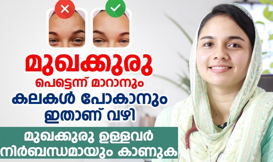 മുഖക്കുരു പരിഹരിച്ച് ചർമ്മത്തെ തിളക്കമുള്ളതാക്കുന്നതിന്…👌