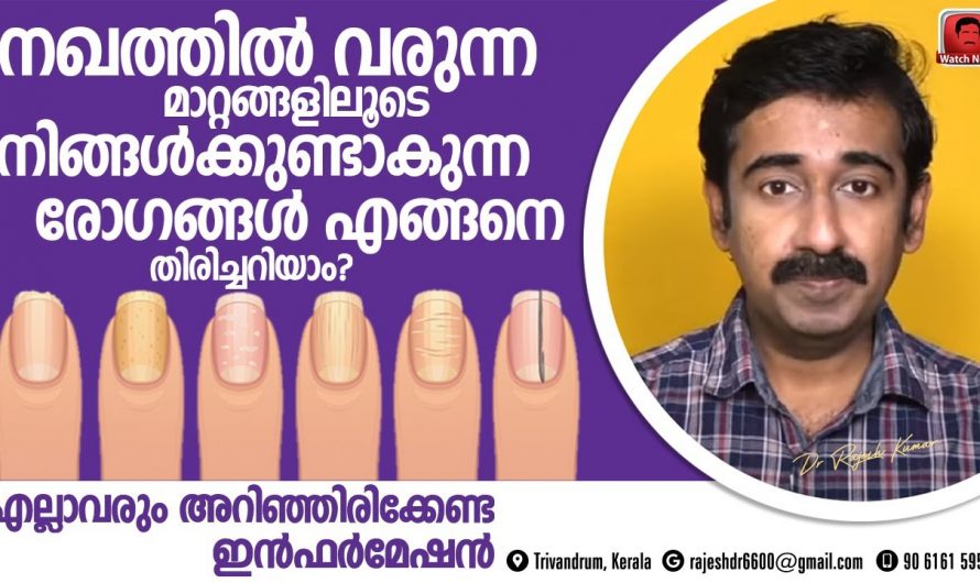 മുഖം മനസ്സിന്റെ  കണ്ണാടി എന്നപോലെ നമ്മുടെ നഖങ്ങൾ ആരോഗ്യത്തിന്റെ കണ്ണാടിയാണ്..😱