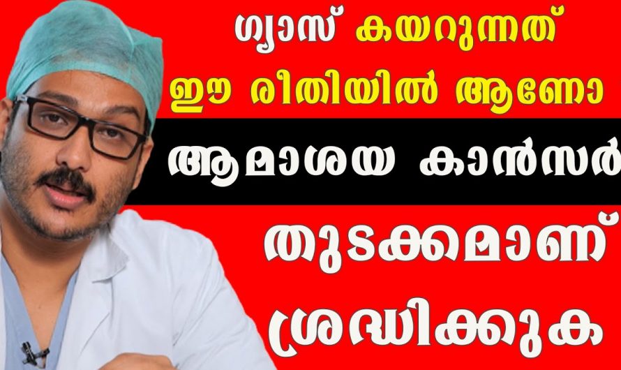 ആശയത്തിൽ  ക്യാൻസർ ഉണ്ടാകുന്നതിന്റെ കാരണങ്ങളും പരിഹാരമാർഗങ്ങളും…👌