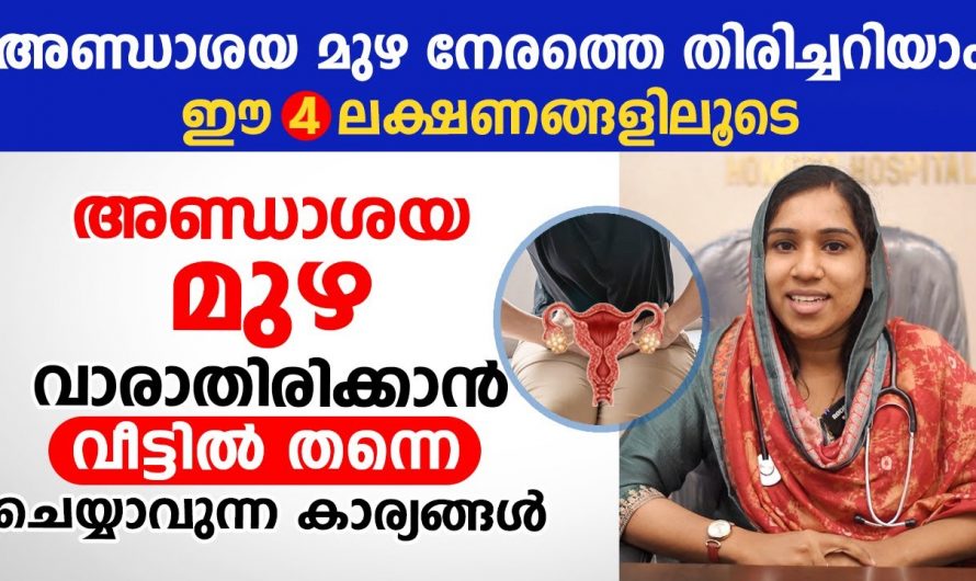 ഇത്തരം സൂചനകൾ കാണിക്കുന്നത് അണ്ഡാശയമുഴകളുടേതാകാം🙄